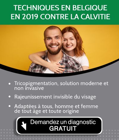 Jeune homme avec une calvitie souriant avec sa copine